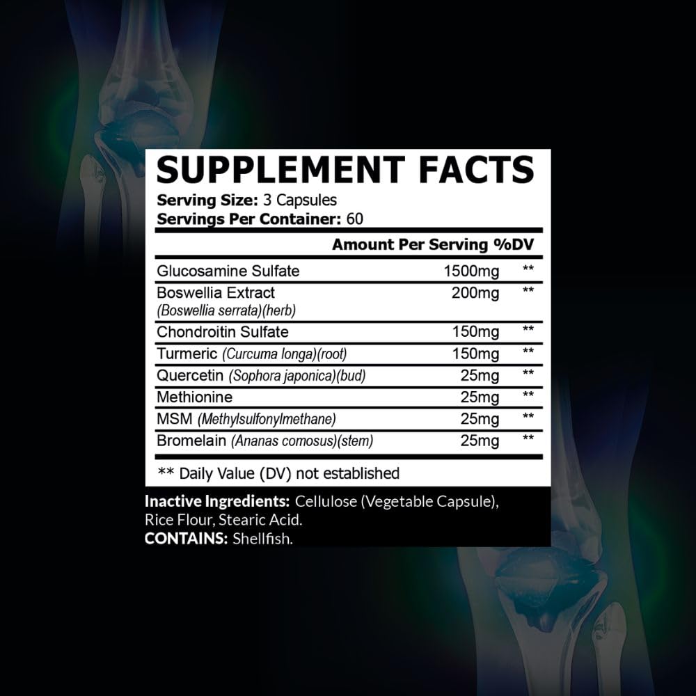 Glucosamine Chondroitin MSM M8304